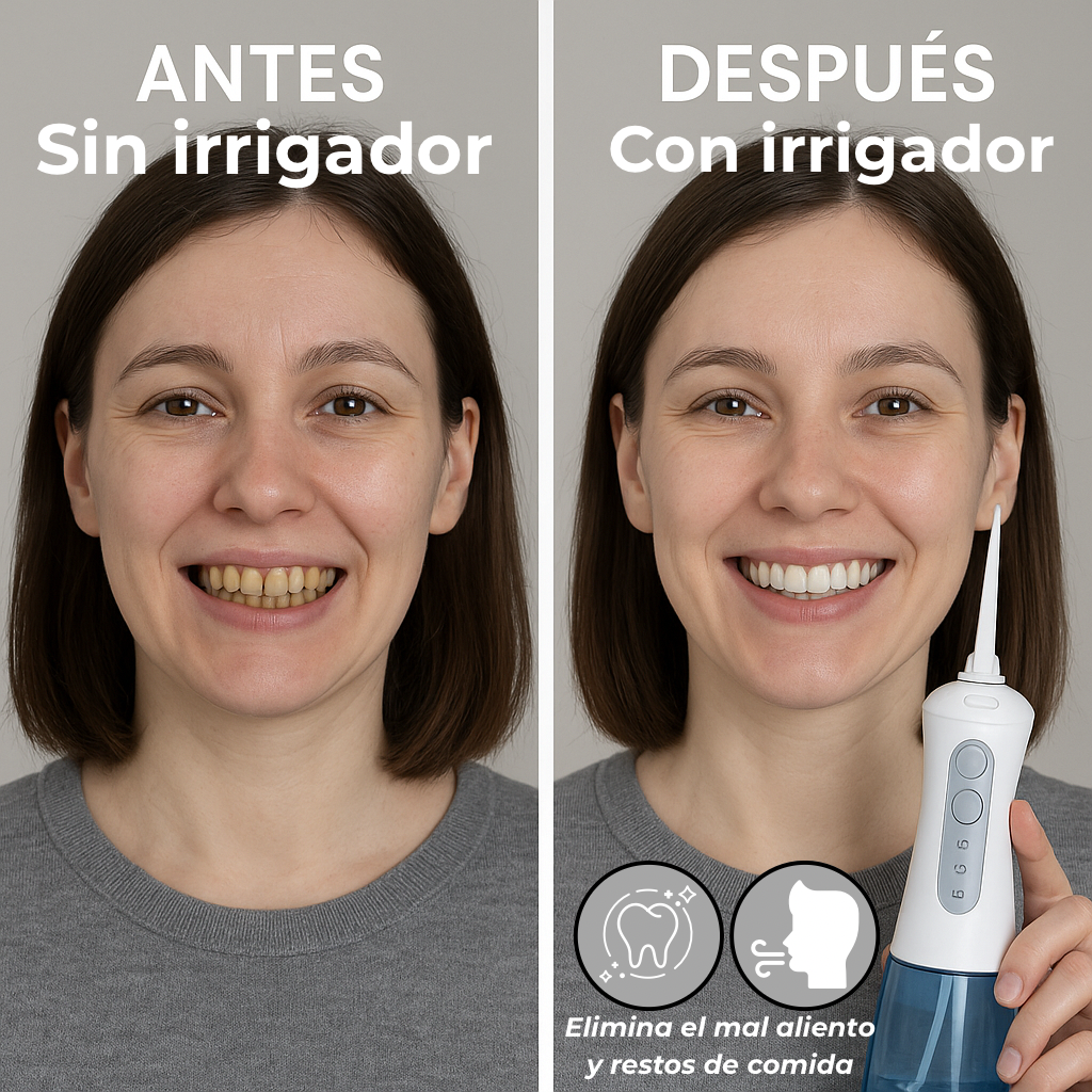 Irrigador Dental Fresh Cleaning: Higiene Perfecta®
