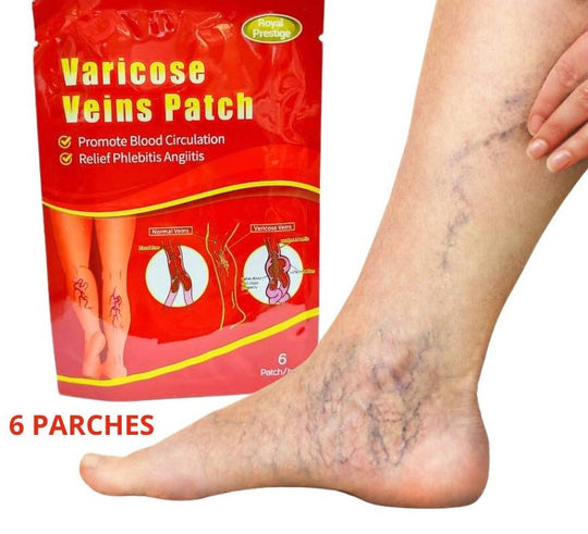 PARCHES PARA VARICES